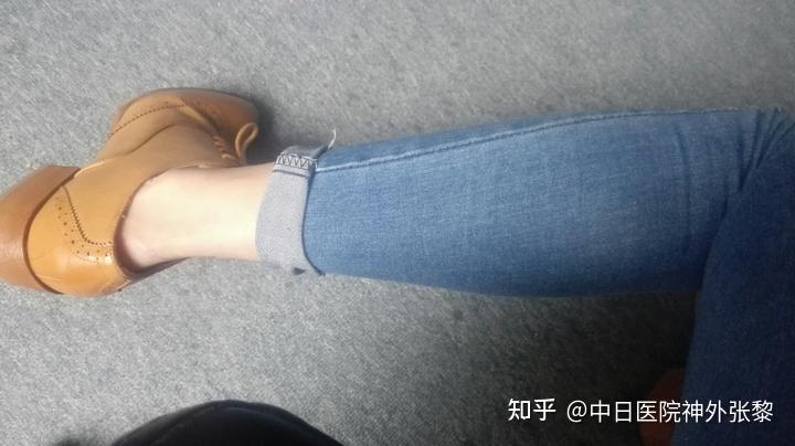 糖尿病周围神经病案例二不合脚的鞋子