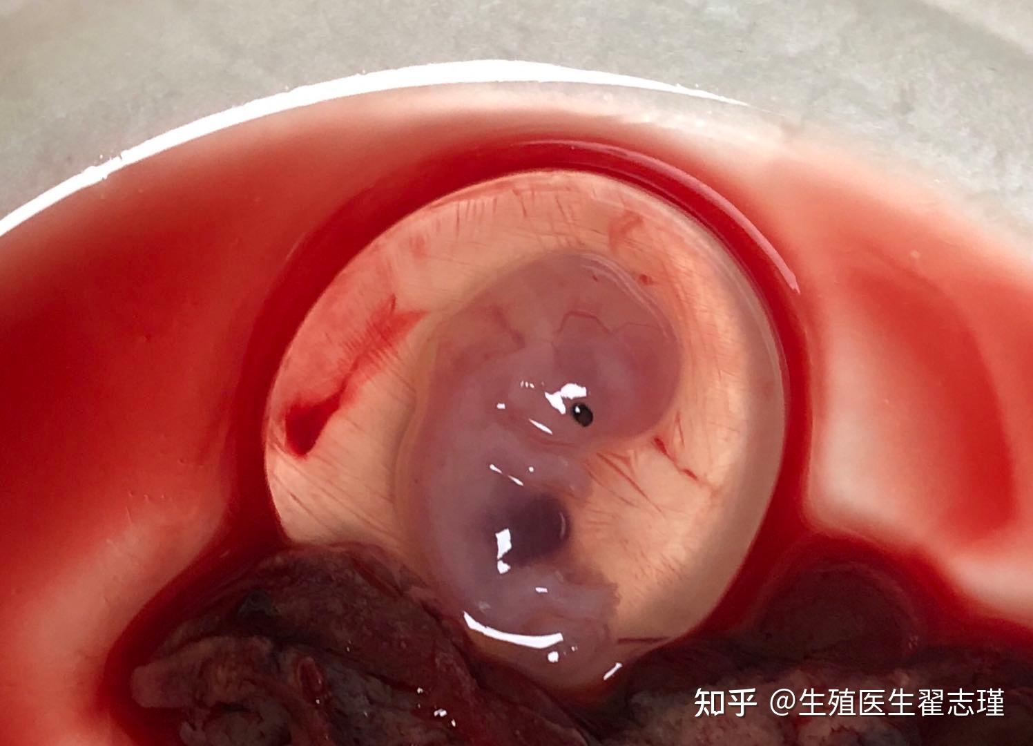 温馨提醒大家,怀孕后,要定期做好产检,同时密切的关注个人的妊娠反应