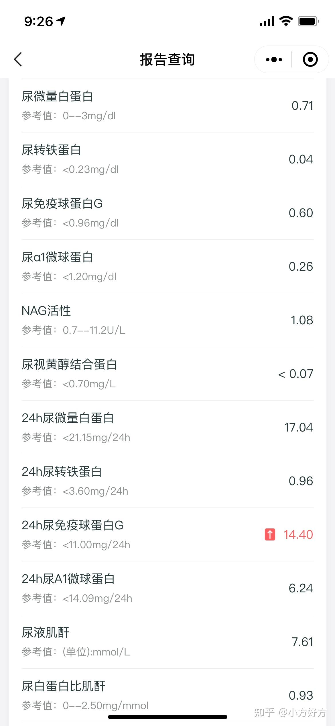 24小時尿免疫球蛋白g偏高