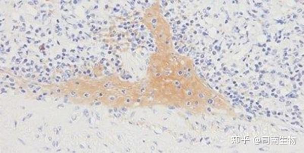 IHC 染色实践指南 - 知乎