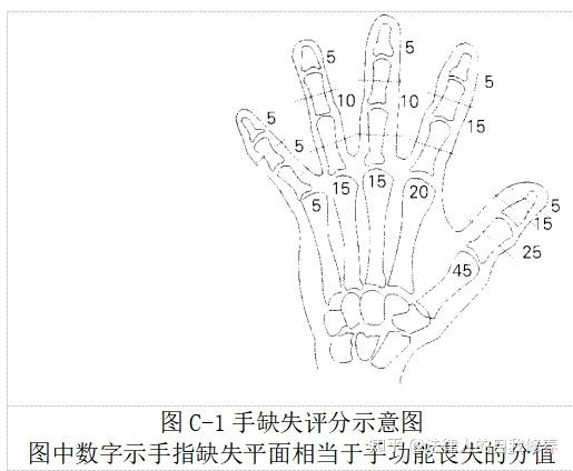 工傷右手無名指斷了一節算幾節傷殘