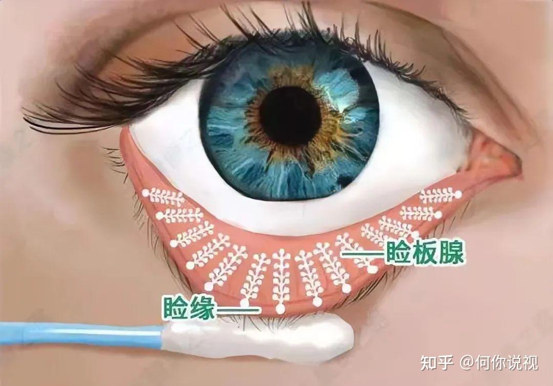 眼皮上长了麦粒肿怎么办？ - 知乎