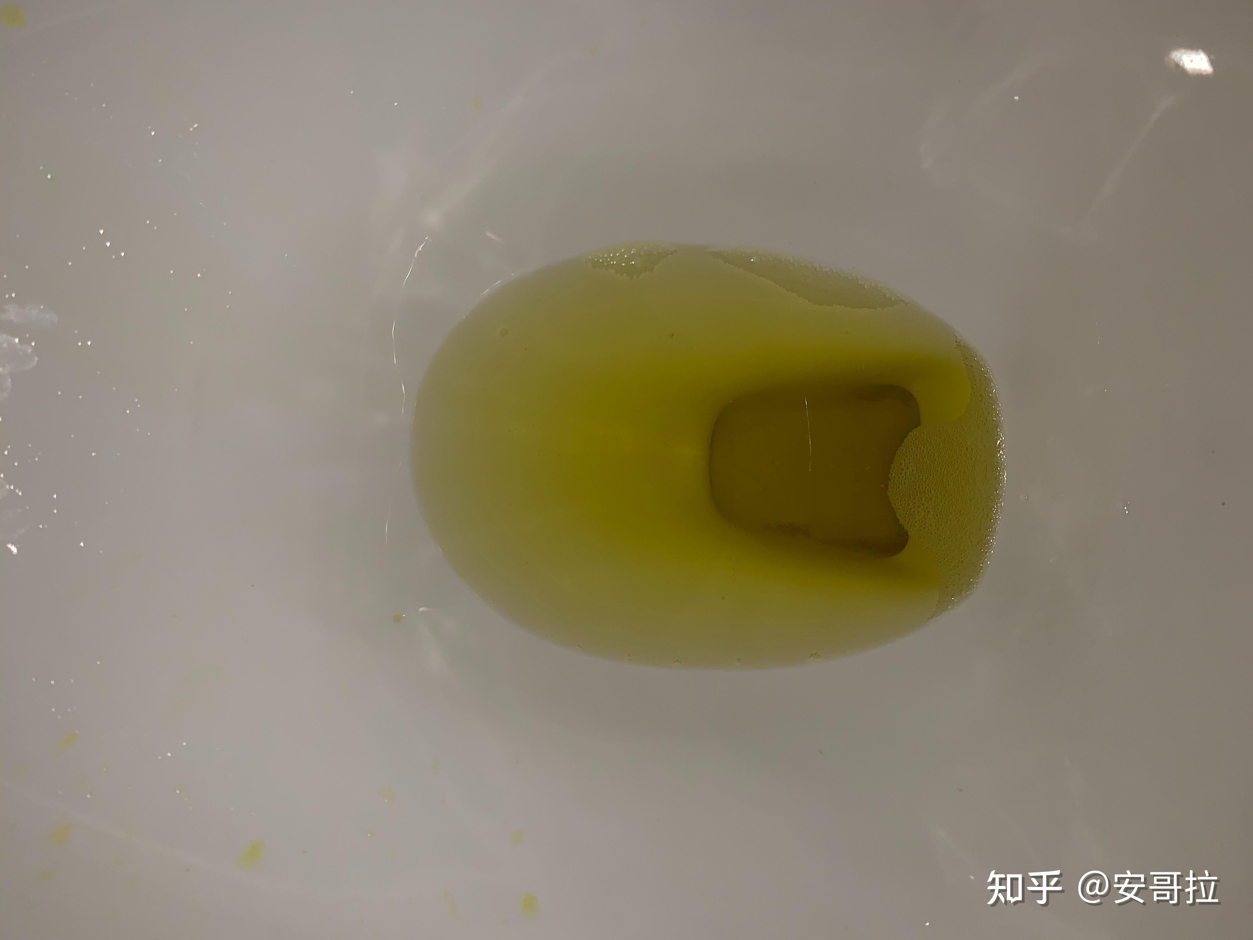 一直拉黄水能做肠镜吗图片