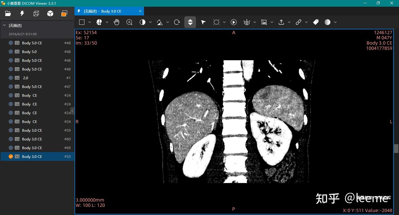医学图像处理资料一览- 知乎
