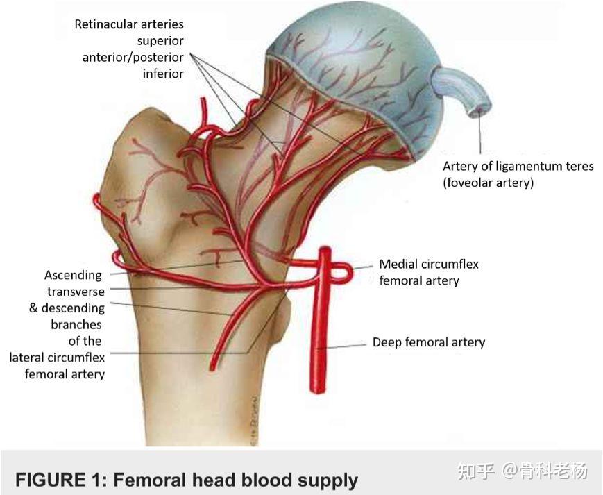 為什麼股骨頭壞死患者x線檢查必須包括雙髖關節股骨頭頸側位片