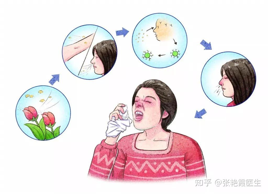 海盐水洗鼻子能治过敏性鼻炎这种说法靠谱吗