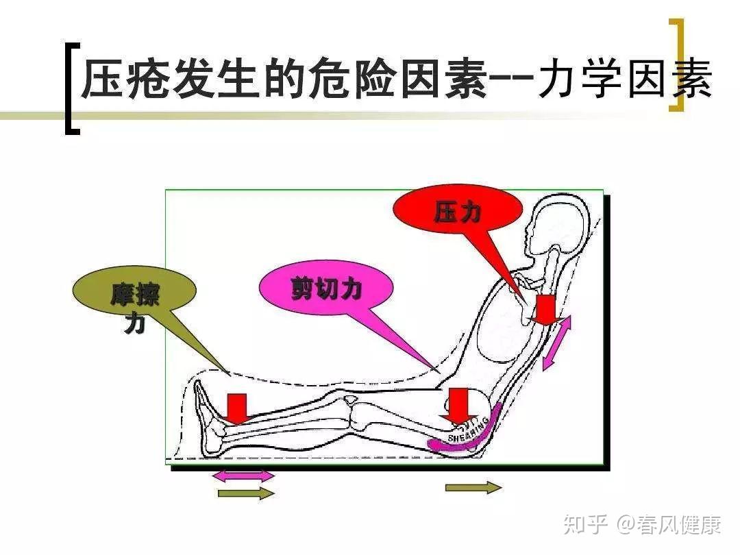 健康前行肺癌术后护理压疮褥疮篇