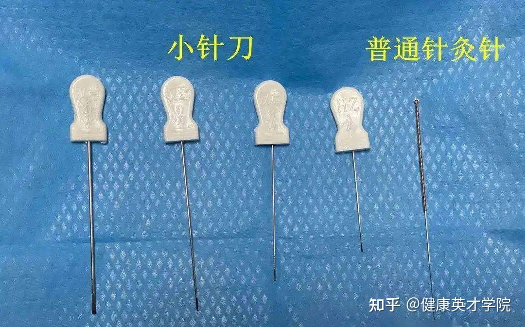 你认识小针刀疗法吗?秒杀疼痛有优势! - 知乎