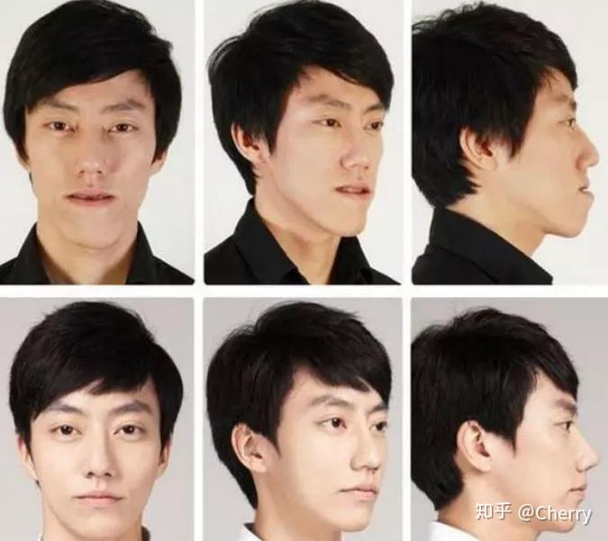 备胎男逆袭追到女神知道真相的我哭了男性整形了解一下