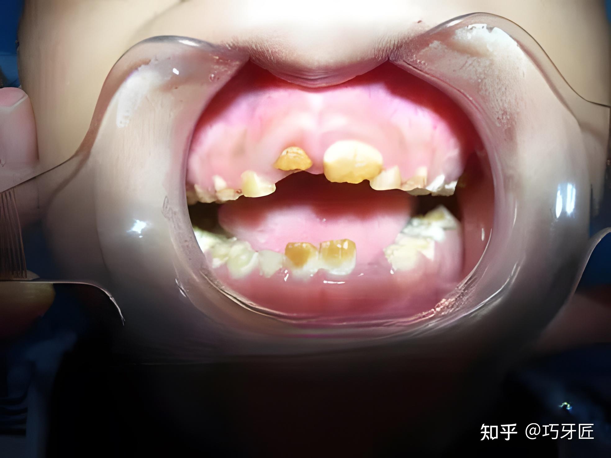 大翔牙醫 - 兒童牙醫