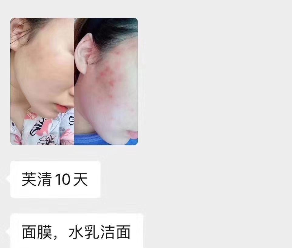 v2-4879bfb6a44579c1cbe2d32427fa8a20_r.jpg