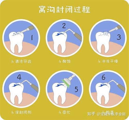 牙齒出現黑線怎麼辦可以自愈嗎