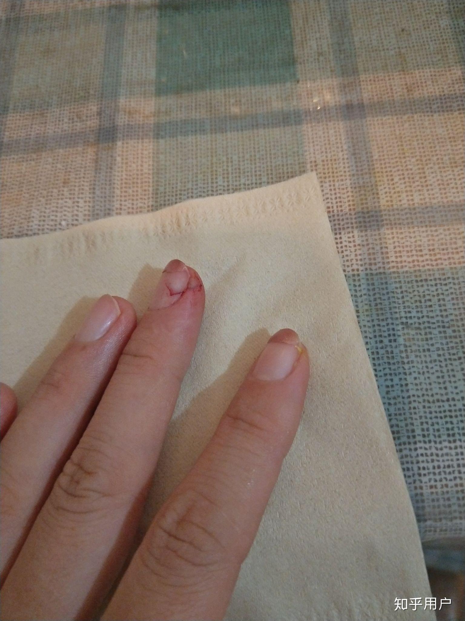 切菜时切到手是一种什么样的体验? - 知乎