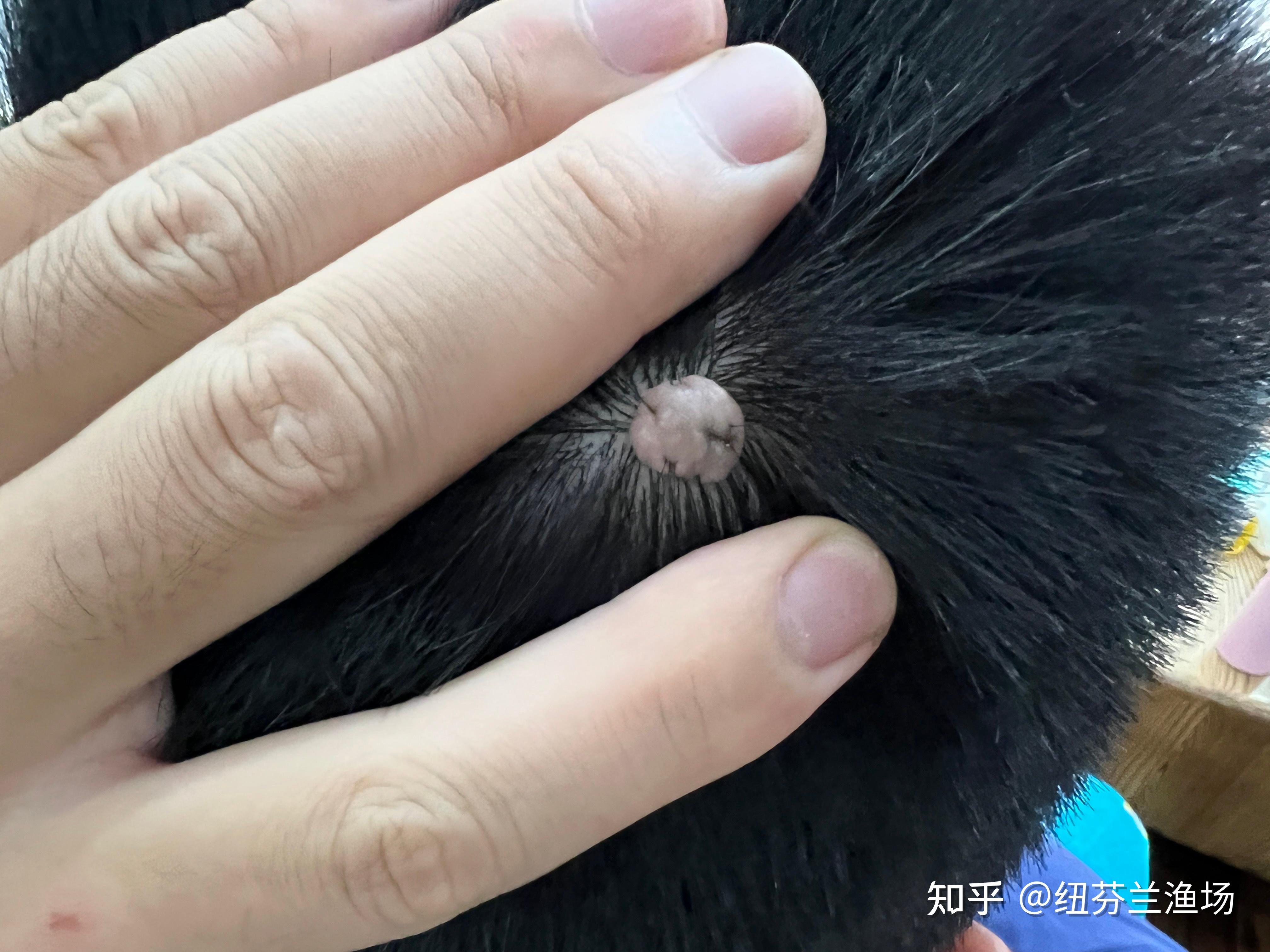这个头皮上的是肿瘤吗? - 知乎