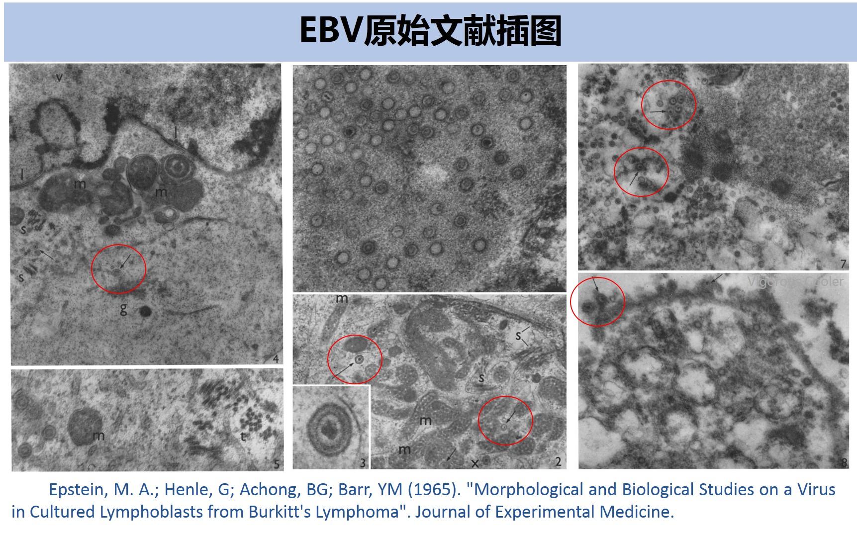 Hsv 1 Vs 2 / Herpes viridae HSV 1,2 and VZV - nicokrijnofoto