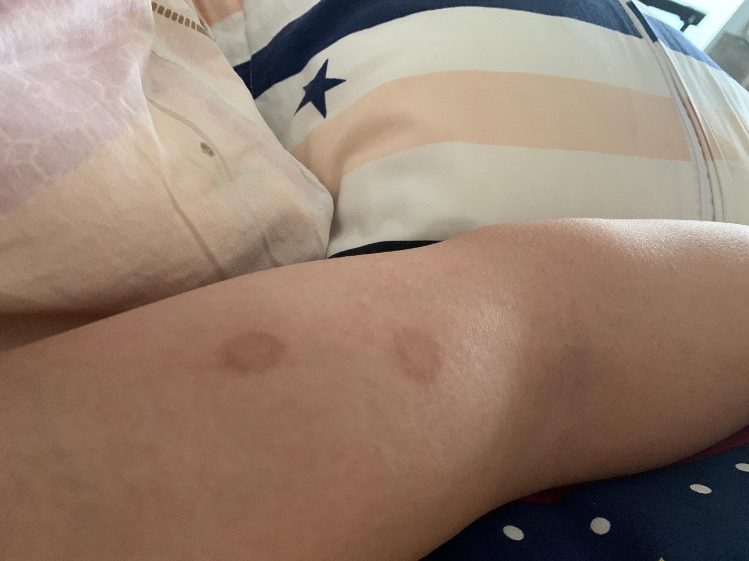 人得了猫癣怎么治疗啊?急 - 知乎