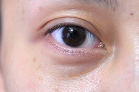v2-49946fea5e03c5cd9b2ef91c75910f3a_1440w.jpg?source=172ae18b