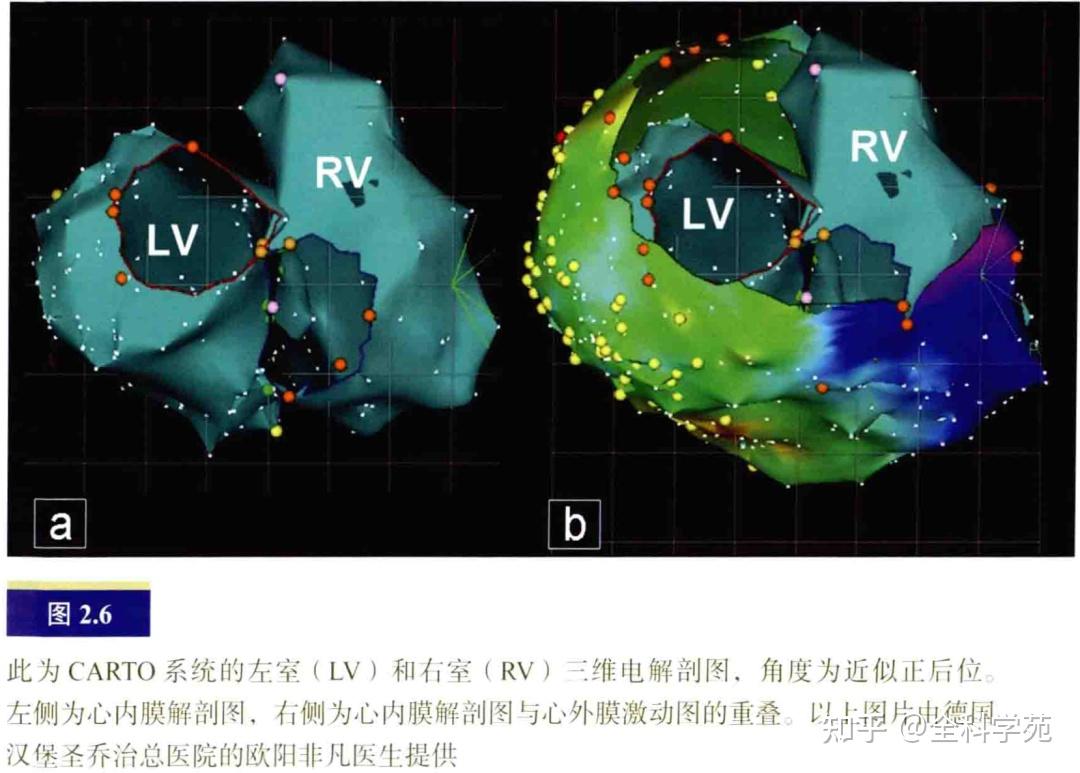 心脏解剖与影像概述：心脏的毗邻结构和附近的易损部位 - 知乎