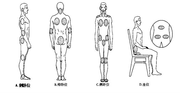 坐位:发生于坐骨结节处