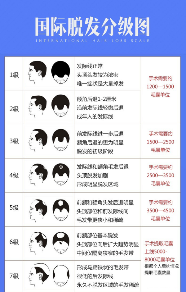 重庆植发最全攻略:治疗脱发多少钱,公立医院私立医院区别,医院医生