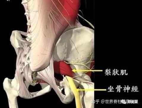 腰臀疼痛腿無力是這塊肌肉的問題沒錯了