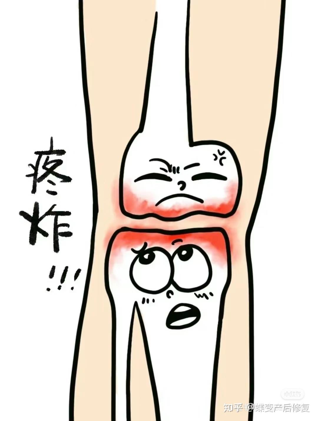 膝盖疼走不了路怎么办