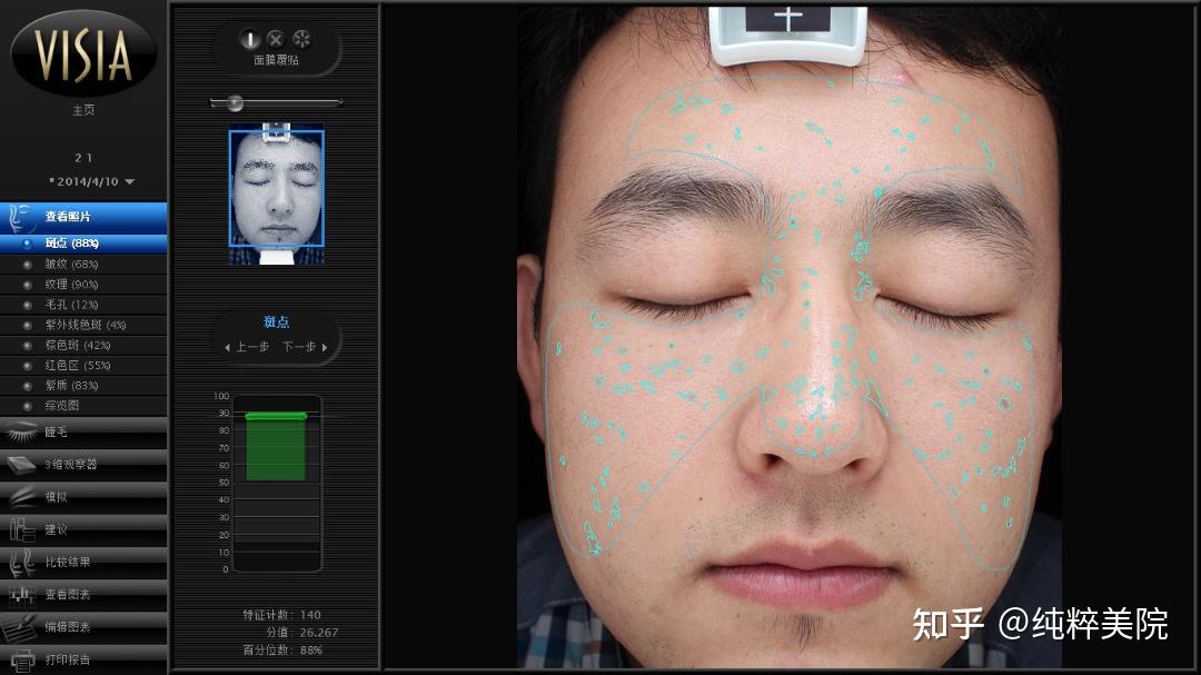 visia皮肤测试结果怎么看?