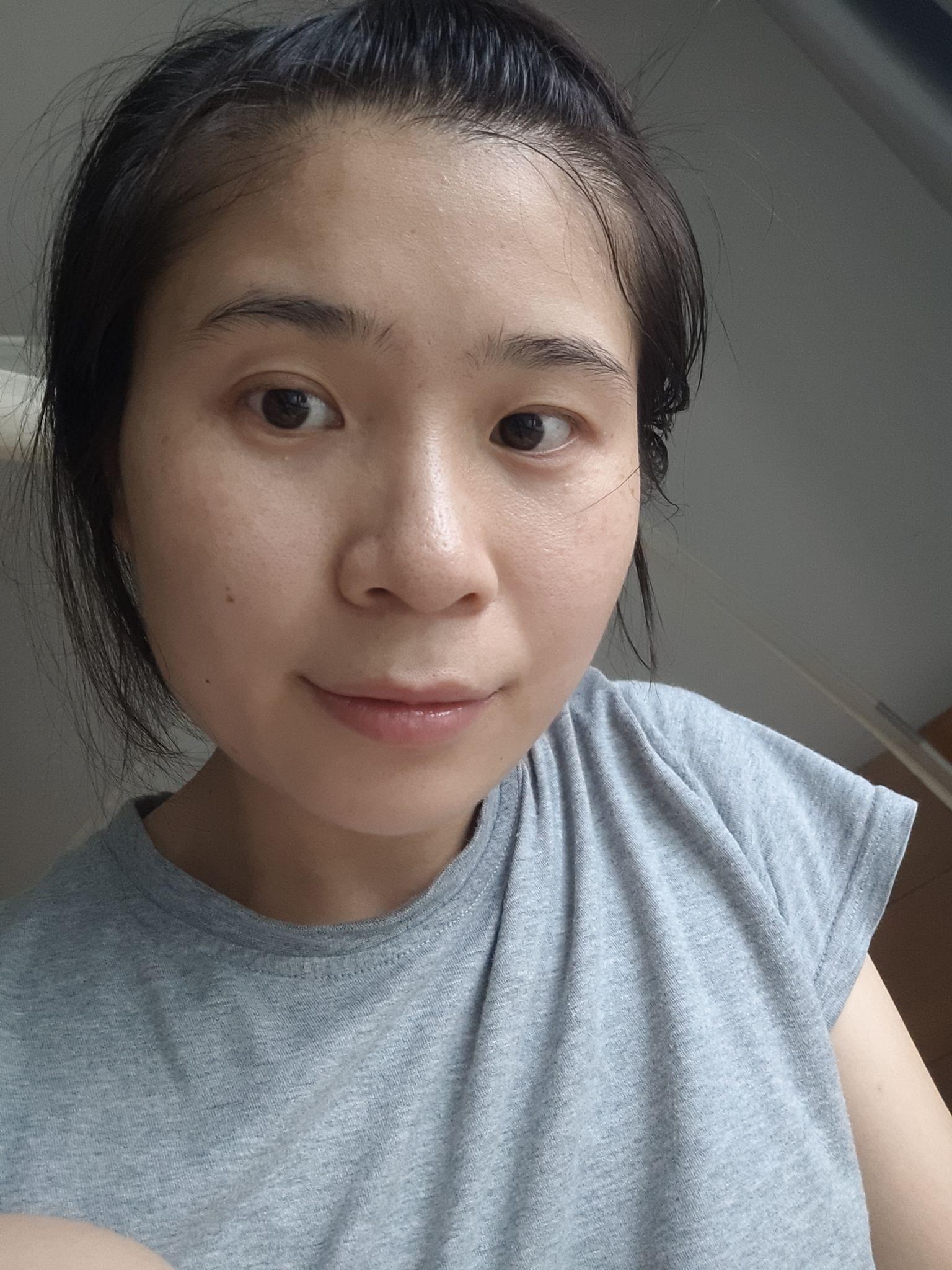 30岁的女性皮肤状态都是什么样的?(不要滤镜)? - 知乎