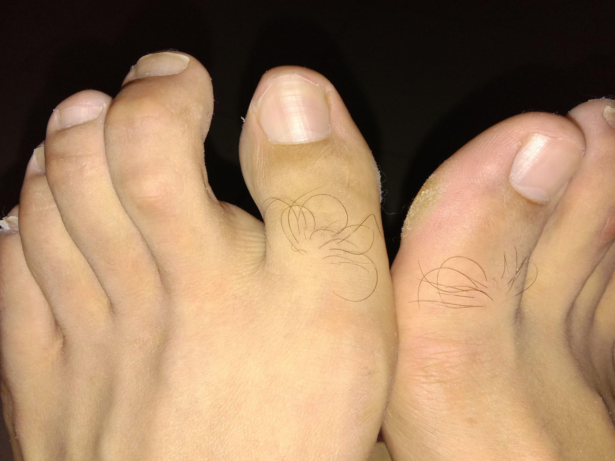 为什么脚大拇指的毛那么长