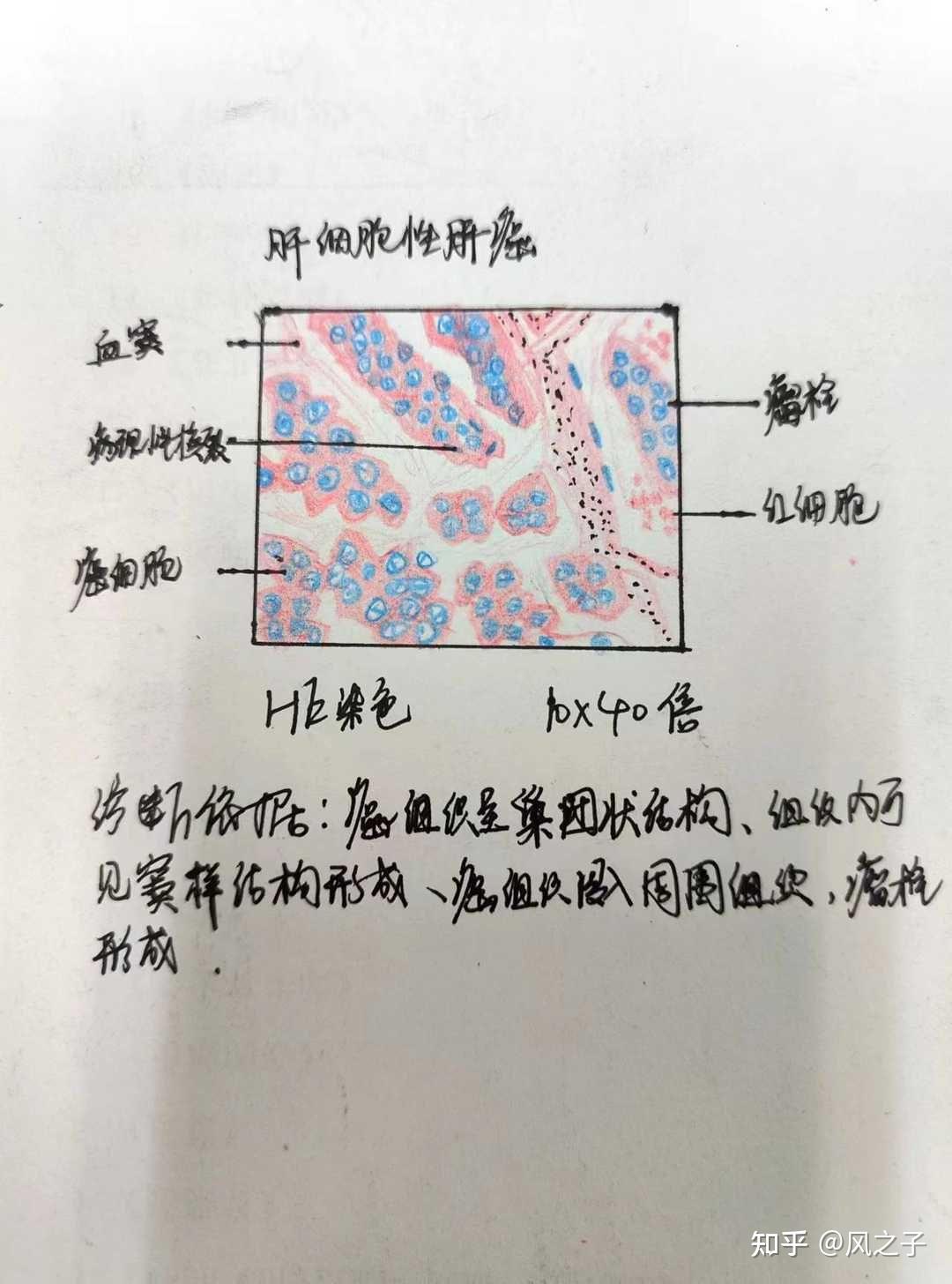 槟榔肝切片绘图图片