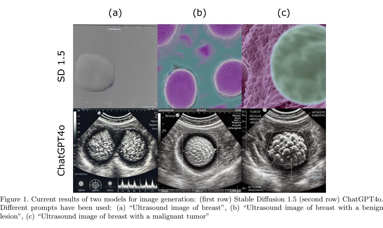 医学影像/Breast Ultrasound