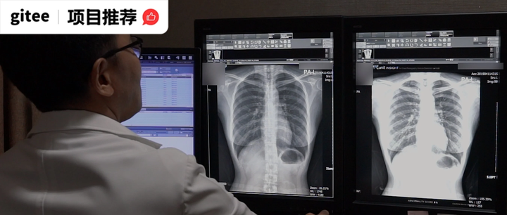 Al+医学,用这个中文多模态医学大模型帮你看胸片 知乎