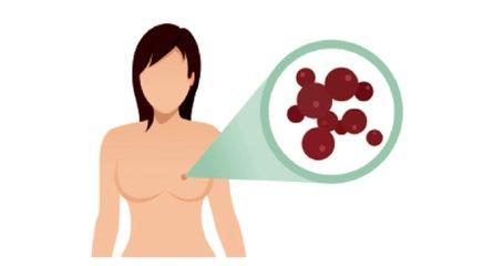 什么是基因突变 v2-4ac52911dad0bedbe657cb5f958809c5_1440w.jpg?source=172ae18b