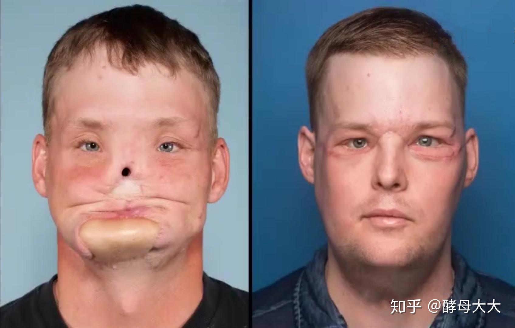 整容的极限是什么?