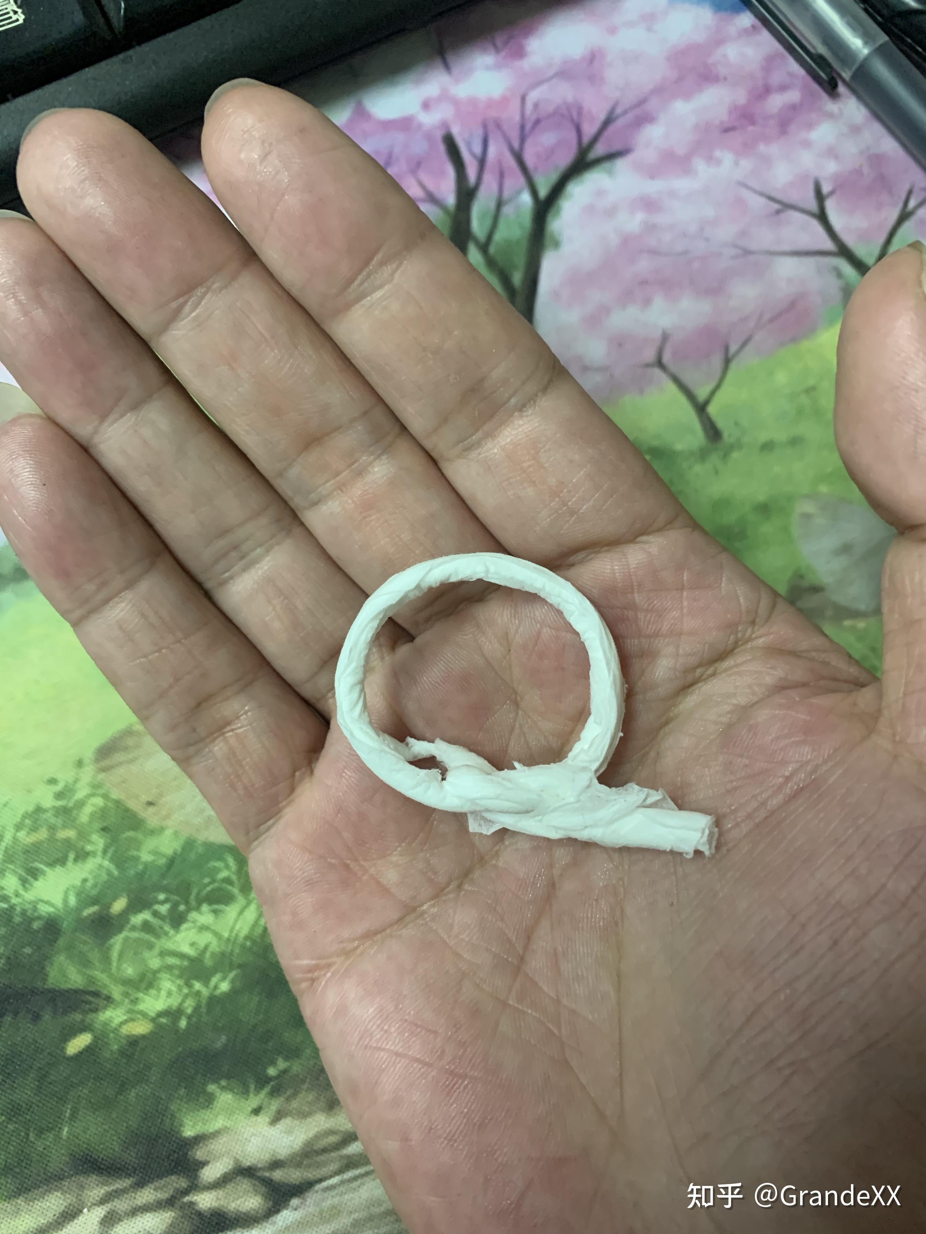 复阻环是否真的能解决包皮过长问题