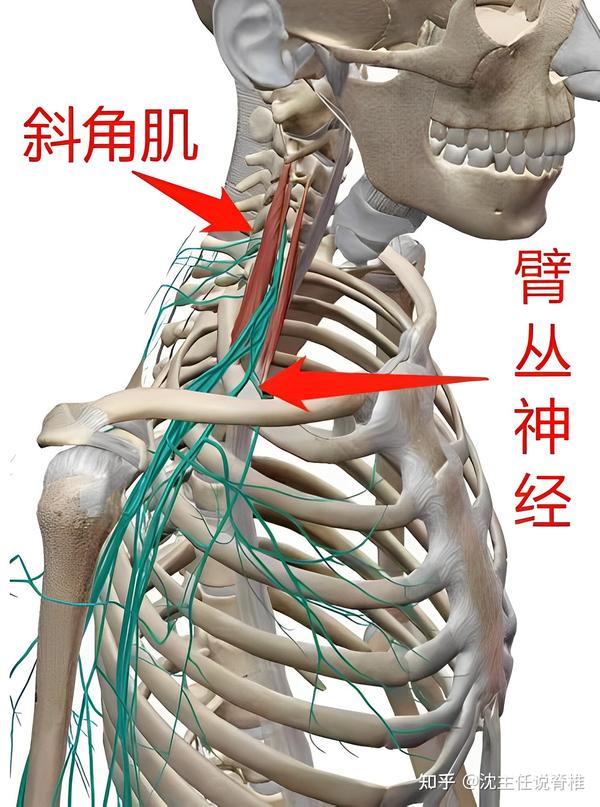 手麻一定是颈椎病吗?医生辟谣,带你了解胸廓出口综合征 - 知乎