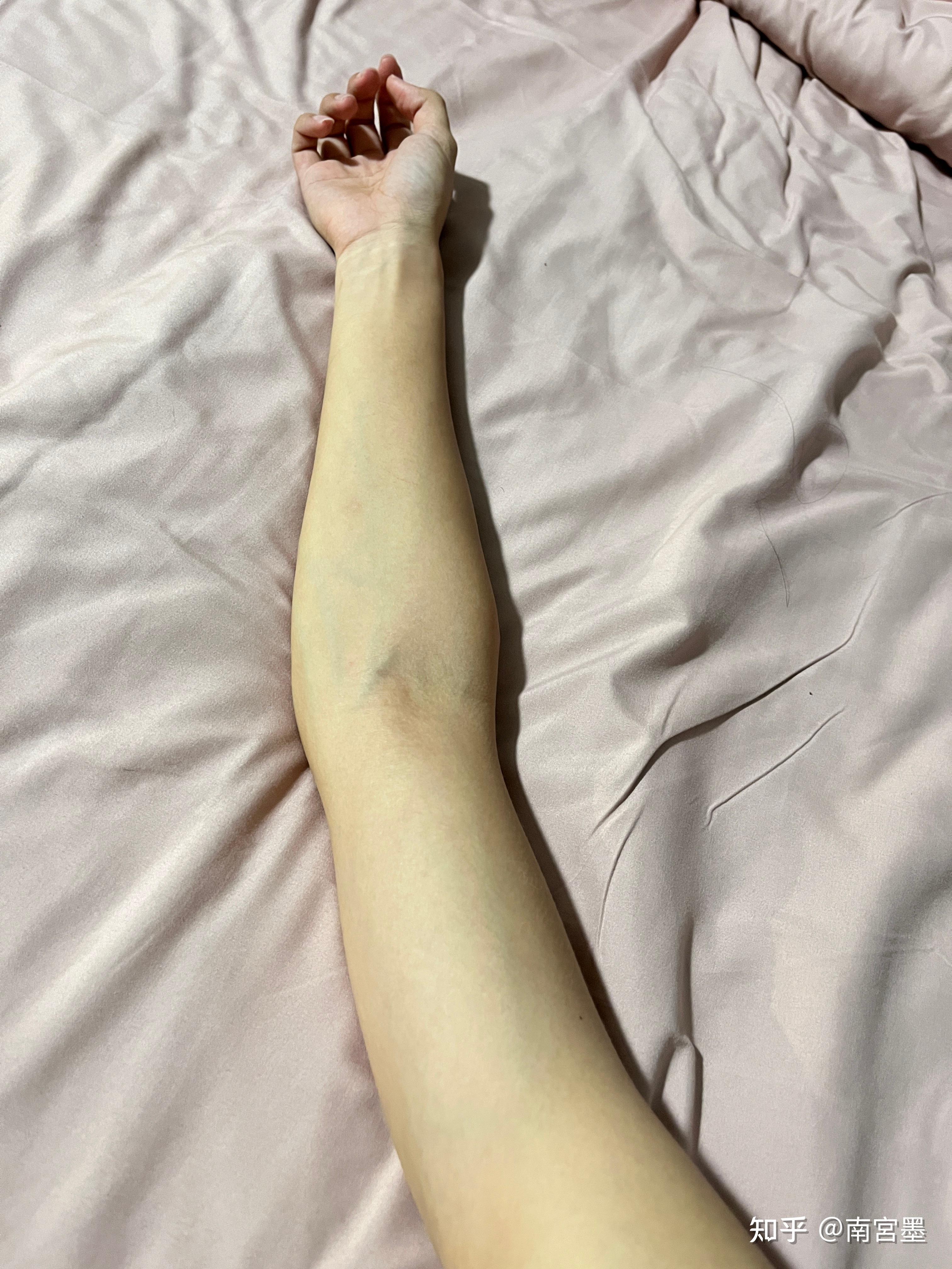 手臂太细是不是没有力气