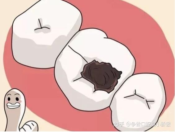 整牙会伤害牙齿吗?辟谣辟谣 - 知乎