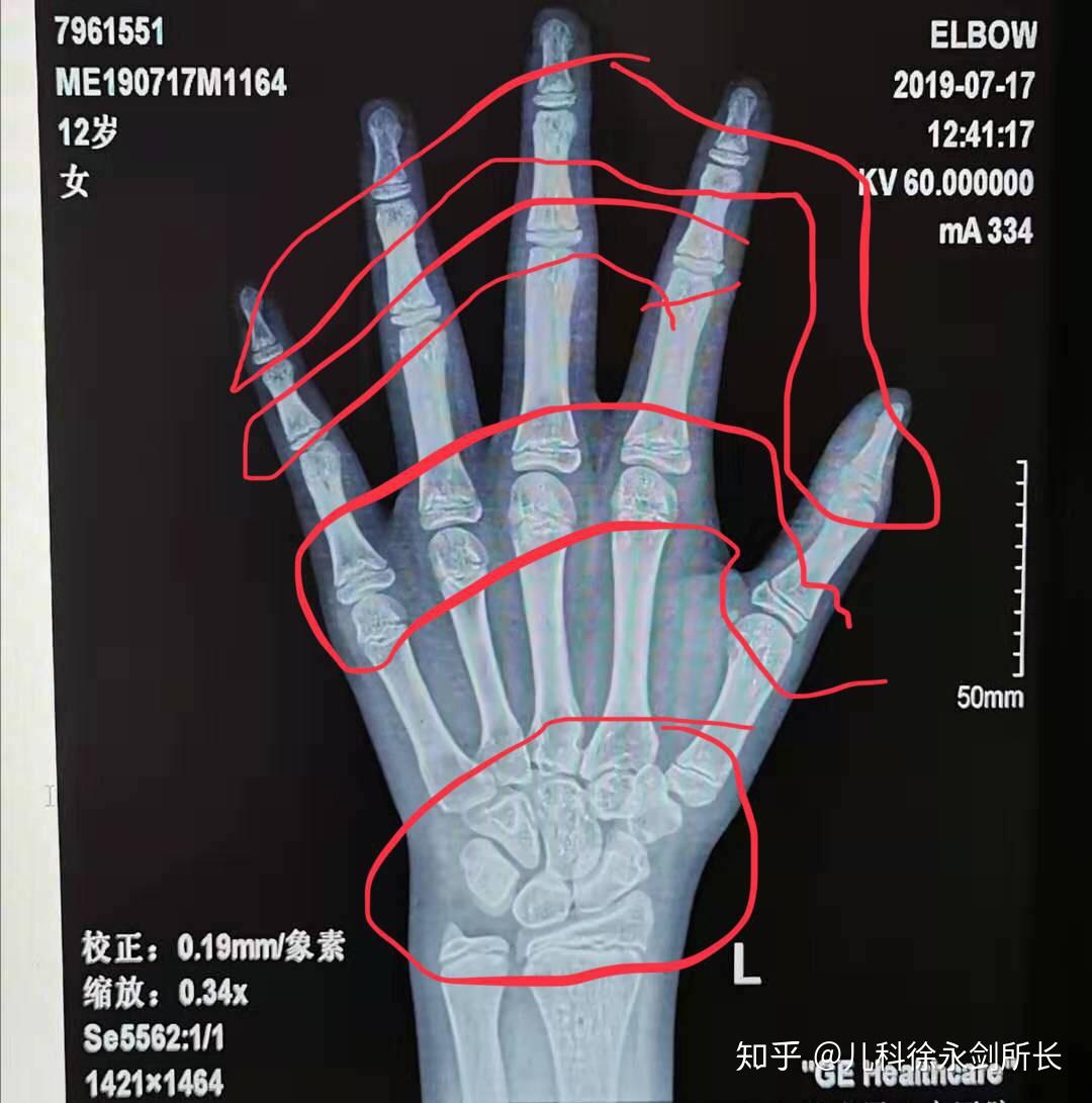 3米,偏矮,怎样才能长高?