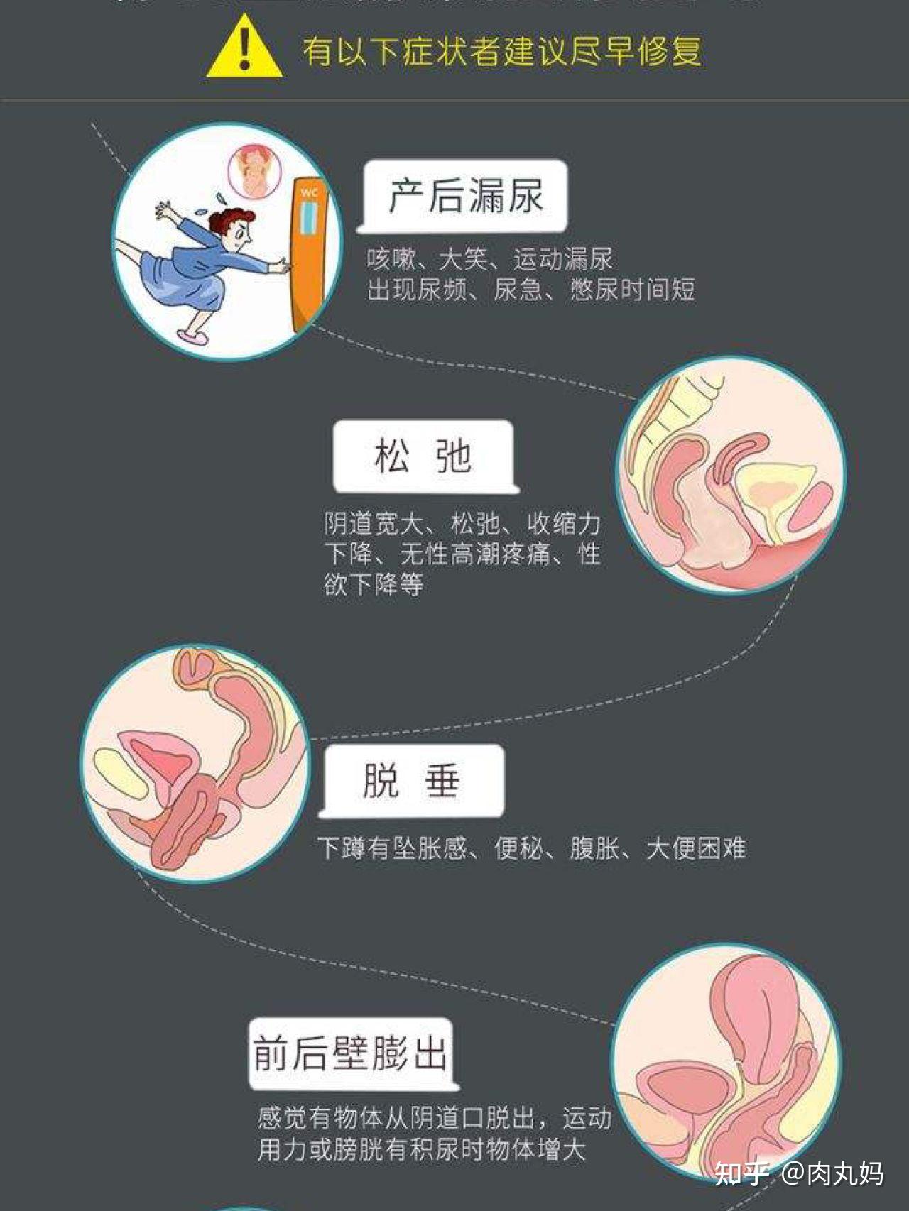 干货丨产后妈妈盆底肌腹直肌修复指南