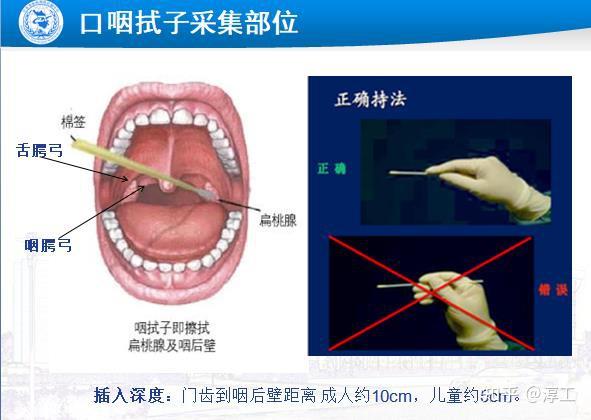 根本没有压舌板可以使用,所以希望居民可以配合医务人员提高采样的