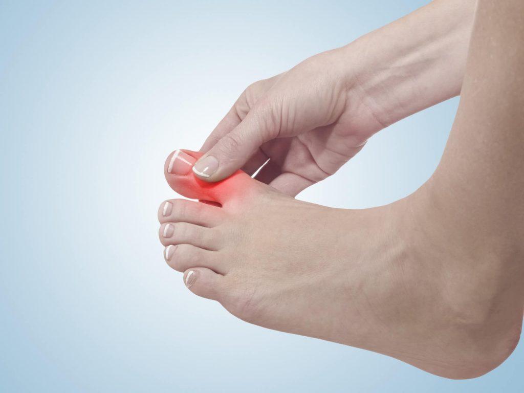 大脚趾关节疼痛的 5 个常见原因