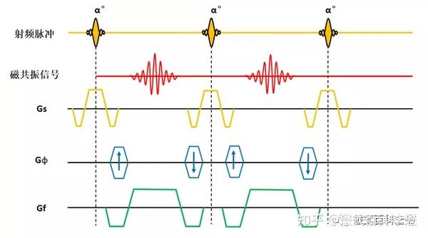 磁共振序列解析之——FFE序列分类 - 知乎