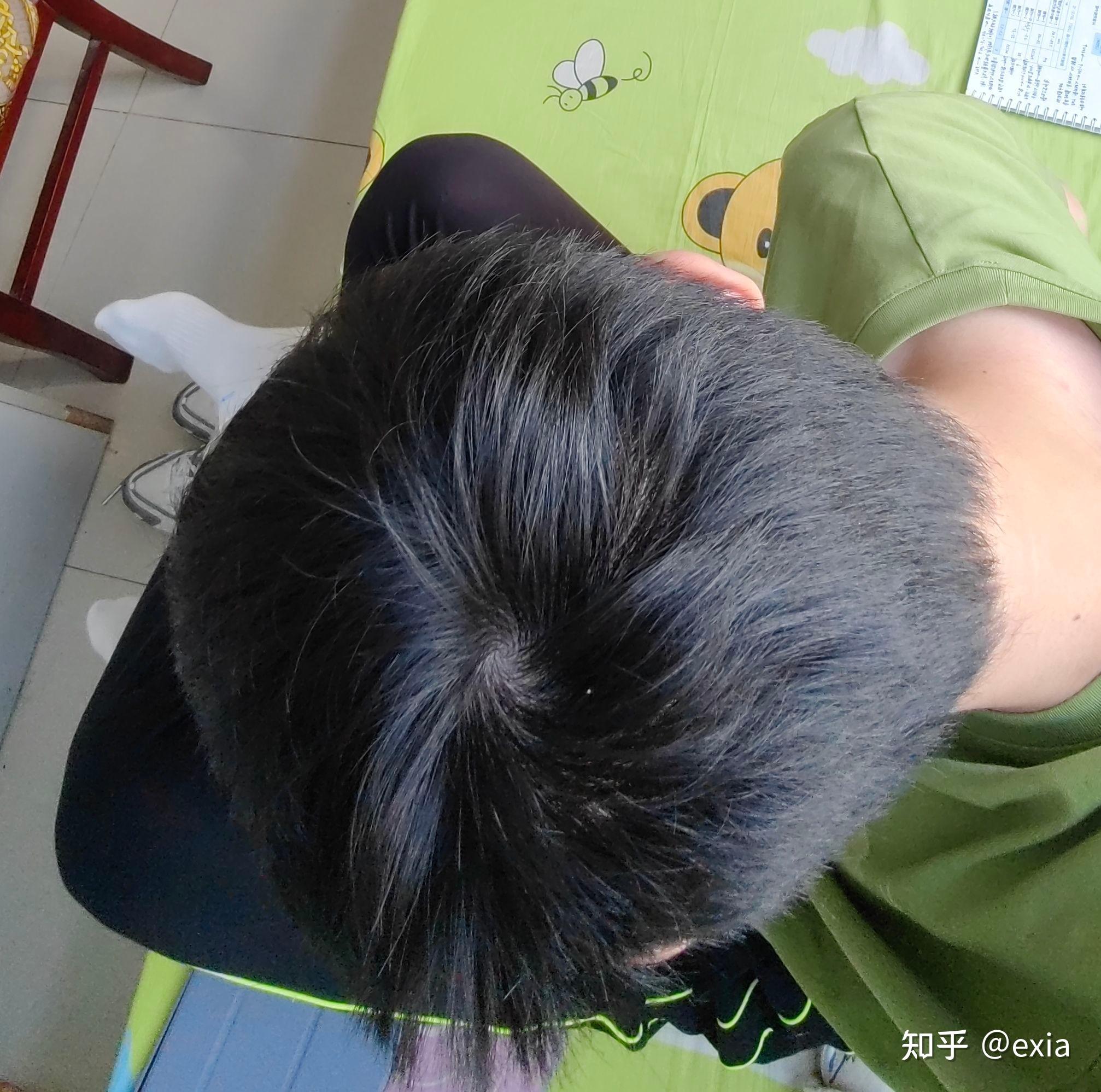 20岁男,头顶这个发量正常吗?