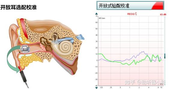 真耳分析優化驗配流程的關鍵