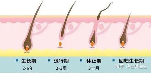 怎样让头发变多变厚(八个方法让头发变浓密)