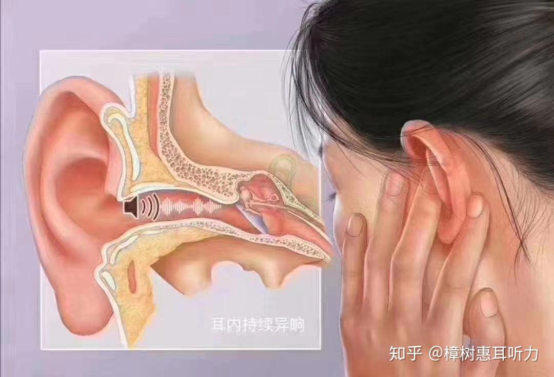 耳鸣的危害有哪些