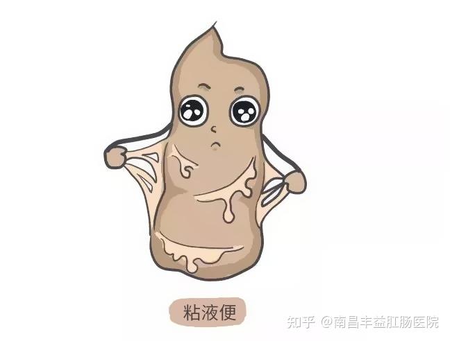 大便有粘液像鼻涕,难道感冒了?可能是这些疾病引起的...... - 知乎
