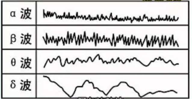 不同的脑电波代表什么?