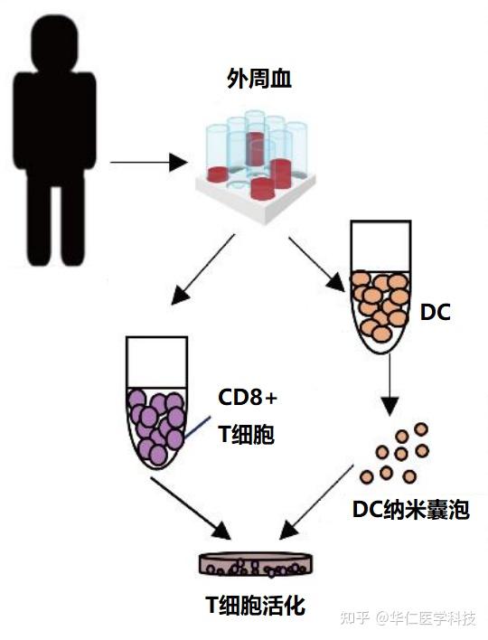 个性化癌症免疫治疗新策略——树突状细胞纳米疫苗 知乎